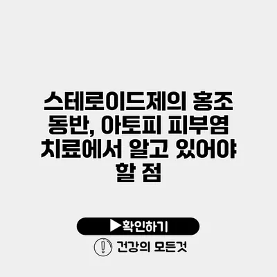 스테로이드제의 홍조 동반, 아토피 피부염 치료에서 알고 있어야 할 점