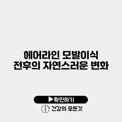 헤어라인 모발이식 전후의 자연스러운 변화